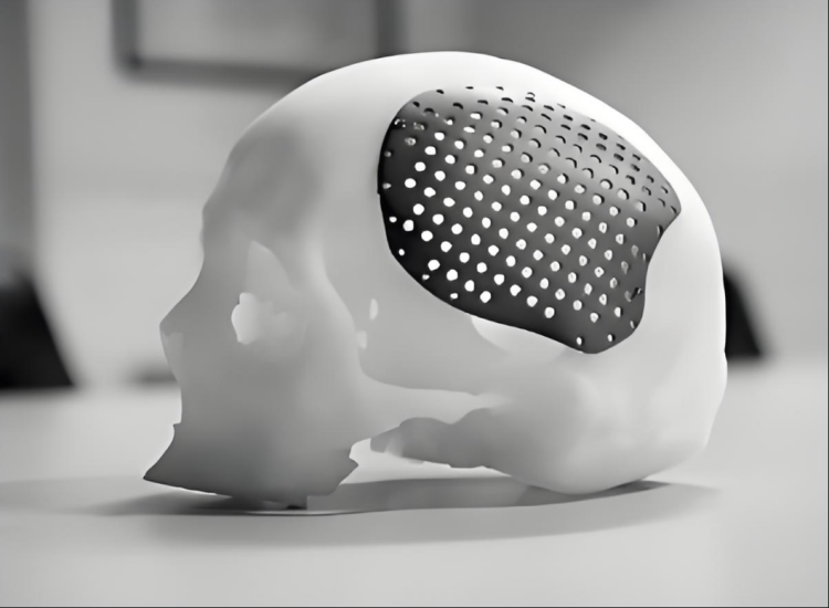 3D printing services----medical industry